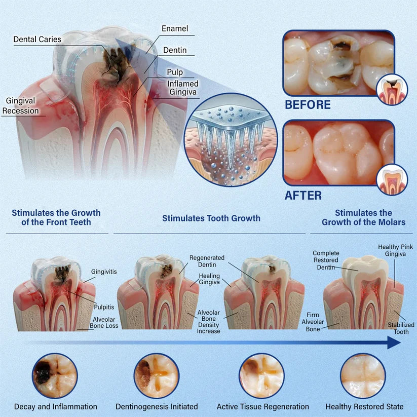 Ceoerty® Tooth & Gum Care Fast-Dissolving Microneedle Patch✨ (𝟓-𝐢𝐧-𝟏 💎 𝐑𝐞𝐛𝐮𝐢𝐥𝐝 𝐄𝐧𝐚𝐦𝐞𝐥 & 𝐃𝐞𝐧𝐭𝐢𝐧 • 𝐒𝐭𝐫𝐞𝐧𝐠𝐭𝐡𝐞𝐧 𝐆𝐮𝐦𝐬 • 𝐄𝐫𝐚𝐝𝐢𝐜𝐚𝐭𝐞 𝐓𝐚𝐫𝐭𝐚𝐫 & 𝐎𝐝𝐨𝐫 • 𝐖𝐡𝐢𝐭𝐞𝐧𝐢𝐧𝐠 • 𝐒𝐭𝐨𝐩 𝐓𝐨𝐨𝐭𝐡 𝐒𝐞𝐧𝐬𝐢𝐭𝐢𝐯𝐢𝐭𝐲)